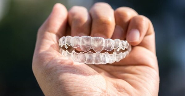 Vivera Retainers